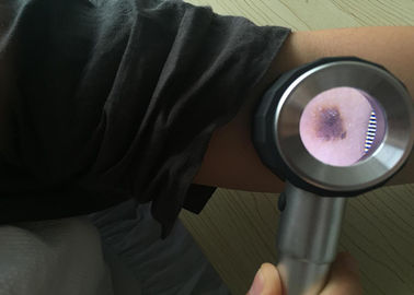 Customized Health Care Handheld Medical Dermatoscope Digital Video Otoscope For Skin Inspection