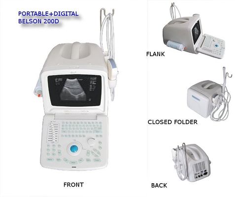 China Digital Portable Portable Ultrasound Scanner BELSON 200D / 3.5MHz R60 Convex Probe factory