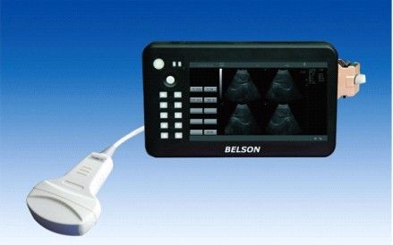 China Palm Ultrasound Scanner Handheld Ultrasonic / Handheld Ultrasound / Belson 3000M+ factory