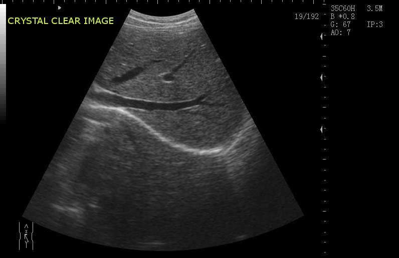 weird town chat mobile ultrasound weird town chat mobile ultrasound