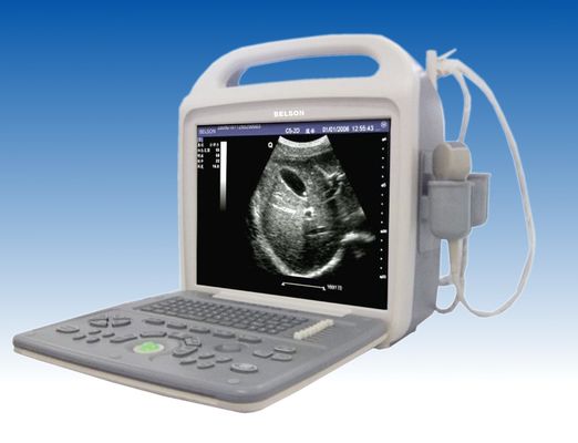 China Big Screen Full Digital Portable Ultrasonic Scanner Device Equipment Abdomen 3000T exporter