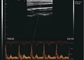 Color Doppler Portable Pocket Ultrasound Scanner Application For MSK Breast Thyroid
