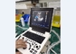 Portable Ultrasound Diagnostic Machine Laptop Probe Color Doppler Equipment