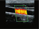 Diagnostic Handheld Ultrasound Scanner Equipment Wireless With 8 TGC Adjustments