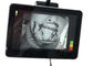 850nm Wavelength Infrared Vein Finder Vein Viewer Version Instrument Suitable For Children Adult Vet