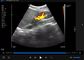 Wireless Ultrasound Probes Handheld Ultrasound Device With B, B/M, Color Doppler, PW, Power Doppler Mode 192 Elements