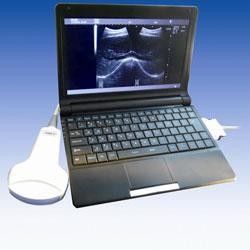 China 10.1 LCD Digital Mobile Laptop Ultrasound Scanner Diagnostic System BELSON 3000M exporter
