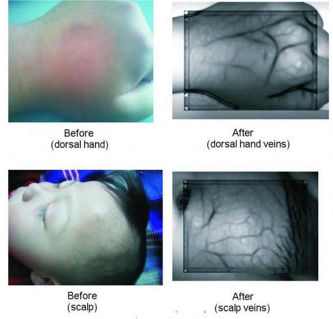 Desk Type Venipuncture Vascular Projection Movable Infrared Vein Finder