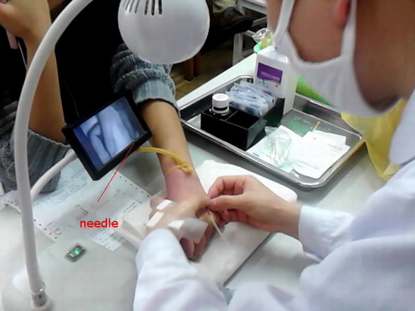 portable flexible screen venipuncture device infrared vein infrared light venipuncture