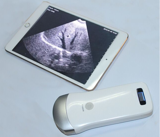 Pocket Ultrasonic Diagnostic Equipment Portable Ultrasound Scanner