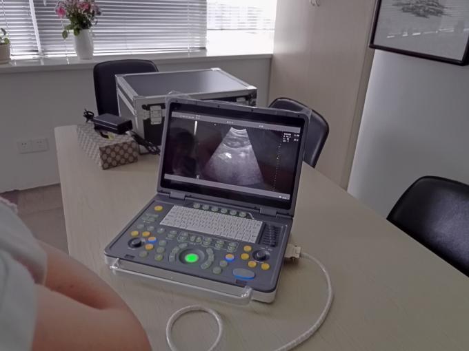 Full Digital Compact Black And White Pregnancy Scanner Ultrasound Machine