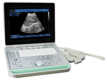 3D Digital Laptop Portable Ultrasound Scanner With All Kinds of Probe