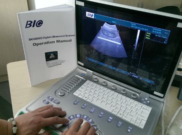 PC Based B / W Portable Ultrasound Scanner 15 inch Laptop Screen Only 5kgs Weight Convenient to Carry
