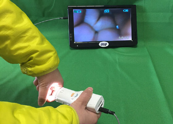 Portable Digital Electronic Colposcope