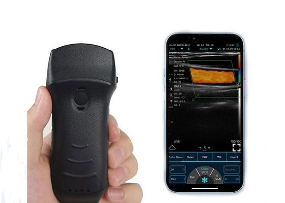 305mm Wifi Portable Ultrasound Bladder Scanner Convex+Linear+Cardiac Probe