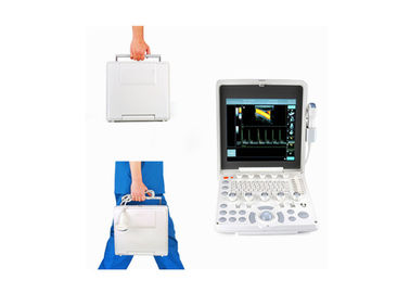 Portable Color Doppler Ultrasound Scanner With 12.1 Inch Screen 2.5-10 MHz Multi-Frequency Probe