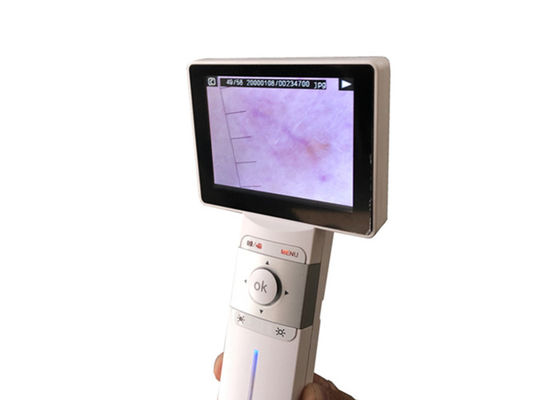 Professional Digital Video Otoscope