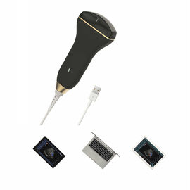 Digital Smart Handheld Ultrasound Scanner Wireless Ultrasound Probe For Puncture Guidance