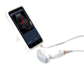 High Resolution Portable Doppler Ultrasound Machine With 6 Inch Full Touch Screen