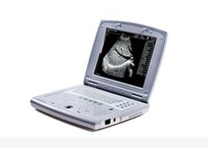 Portable Baby Ultrasound Machine Portable Ultrasound Scanner for Pediatrics