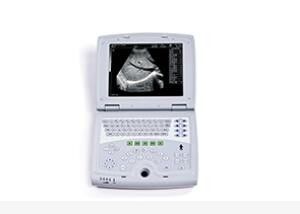 Mobile Ultrasound Machine Digital Laptop Ultrasound Scanner with 100 Frames Permanent Storage