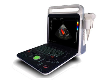 Digital Ultrasound Scanner Portable UItrasound Scanner 4D Cardiac Probe Optional