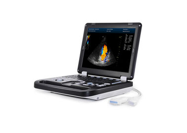 256 Portable Ultrasound Scan Machine 3D Digital Portable Ultrasound Scanner