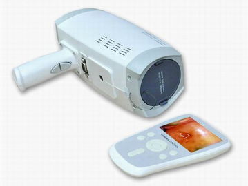 Lens Resolution 800000 Pixels Digital Electronic Colposcope With Automatic Electronic Shutter 3.5 Inch Handheld Screen