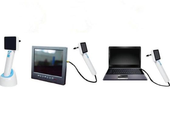 4 Natural White LED Medical Video USB Otoscope  Otoscopy With Image Stored in Computer Diameter of Lense 0.5cm