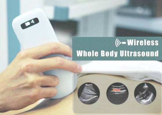 3.6Mhz Electronic Array Digital Ultrasound Scanner For Abdomen Cardiac