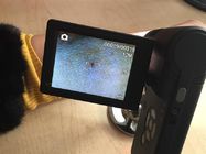 Handheld Dermatoscope Handheld Microscope Digital Skin Inspector With 9 Kinds Languages
