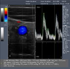 3D Laptop Ultrasound Scanner Color Doppler Machine With Large Volume Hardisk