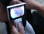 Lcd Monitor Digital Video Otoscope Ophthalmoscope For Clinical Inspection Of Human Body