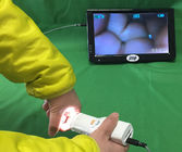 Self - Inspection Tool for Cervical Examination Digital Electronic Colposcope Applicable Individual Clinic and Hospital