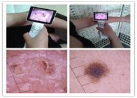 1920*1080 Pixels Handheld Usb Video Dermatoscope Skin Microscope and Measurement With USB Port Wifi Optional