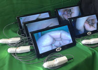 Portable Self-Colposcope For Gynecology Connected To Monitor Computer Television