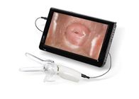 Mini Colposcope for Cervical Examintion Vaginal Camera Connected to TV or PC