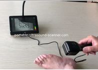 Medical Vein Viewing System Infrared Vein Locator Handheld Pocket Vein Viewer with LED Light