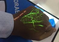 Mini Vein Locator Device Display A Map Of Vasculature On The Surface Of The Skin In Real Time