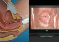 High Definition Women Self-Examination Endoscope AV ( video ) Signal Digital Electronic Colposcope