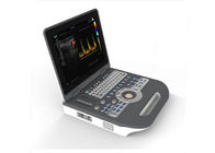 Full Digital Color Dopple Machine Portable Diagnostic Color Ultrasound Scanner