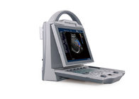 Digital Color Doppler Machine Laptop Ultrasound Scanner Diagnostic Color System