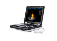 2 Probe Connectors Color Doppler Machine System Laptop Ultrasound Scanner With Trolley Optional