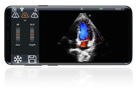 Wireless Color Handheld Ultrasound Probe Scanner Digital Ultrasound Cardiac Transducer