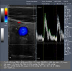 3d Color Doppler Ultrasound Scanner / Hand Held Doppler With Built - In Battery