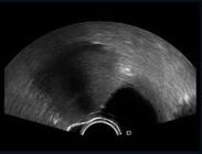Transvaginal Probe Color Doppler Ultrasound Scanner , Handheld Doppler Pregnancy