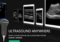 USB Port Home Color Doppler Ultrasound Scanner With 5~10 MHz Frequency