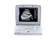 Digital Ultrasound Machine Portable Black and White Ultrasound Scanner in Four Languages