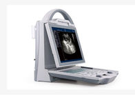 Hand Held Ultrasound Devics Portable Ultrasound Scanner with 10.4 Inch High Resolution Screen