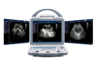 Hospital Ultrasound Machine Portable Ultrasound Scanner with Dual Probe Connectors